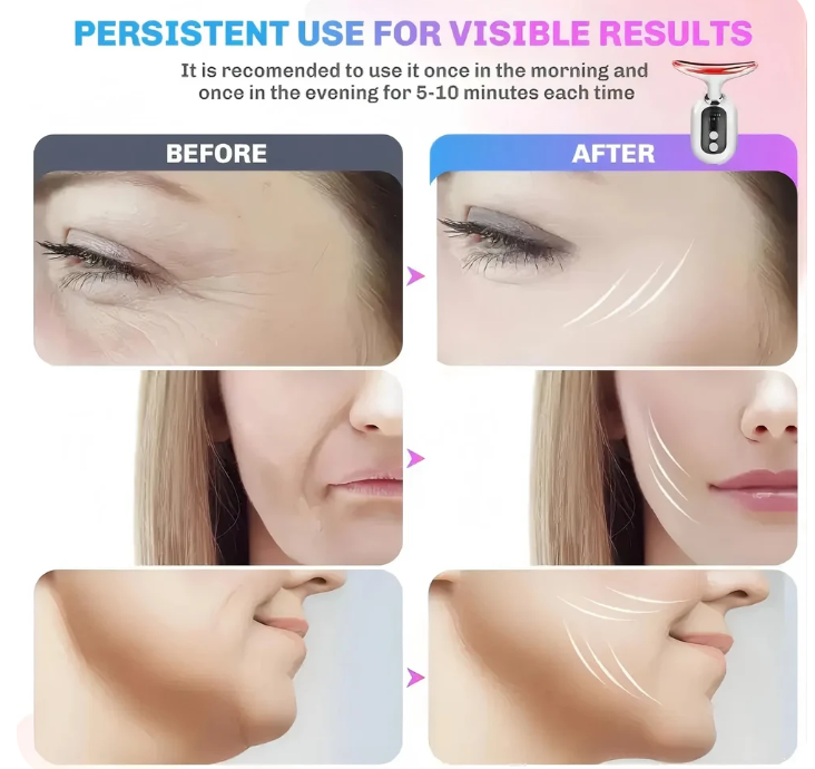 FibraGlow Facial Rejuvenation Massager
